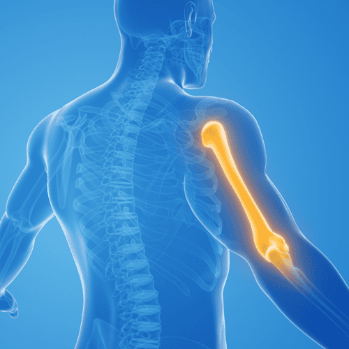 Shoulder and Elbow Surgeries in Mexico: Affordable and Quick Solutions for Canadians